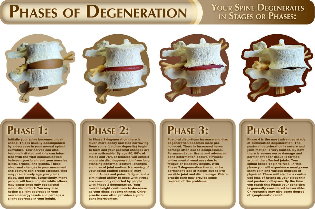 Degeneration Wall Decal Poster